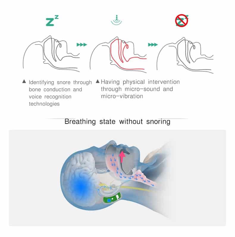 Snoring circle intelligent snoring stop device - Y5 HK